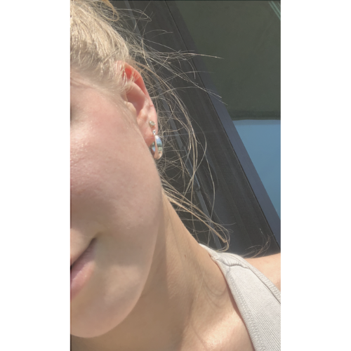 Calm Elements customer, Valeria, showing their skin after Calm Elements